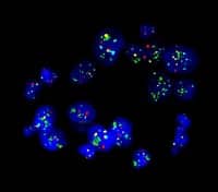 NeoGenomics BarrettsAssay