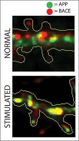 UCSD Alzheimers